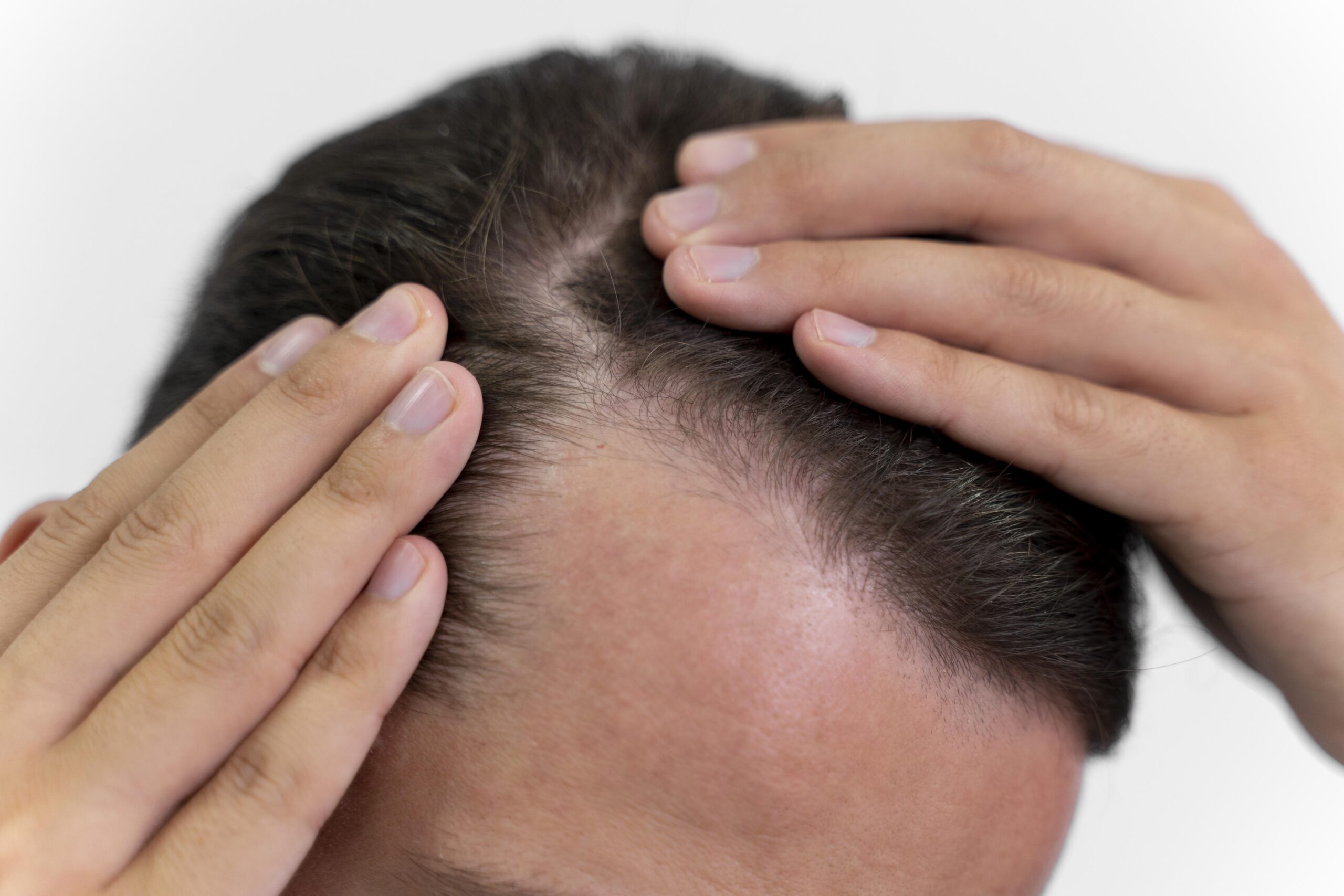 Fase 2 de l’estudi de Kapil hair care